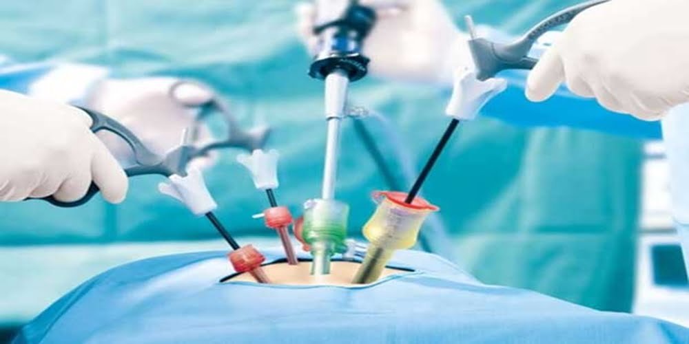Laparoscopic Surgery (Keyhole surgery) 2 Best Laparoscopic Surgeon in Lucknow - Dr. Devanshi Gupta
