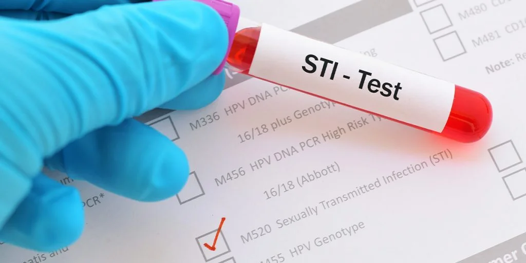 STI Screening (STD Test) 2 Sexually Transmitted Infection Doctor Lucknow