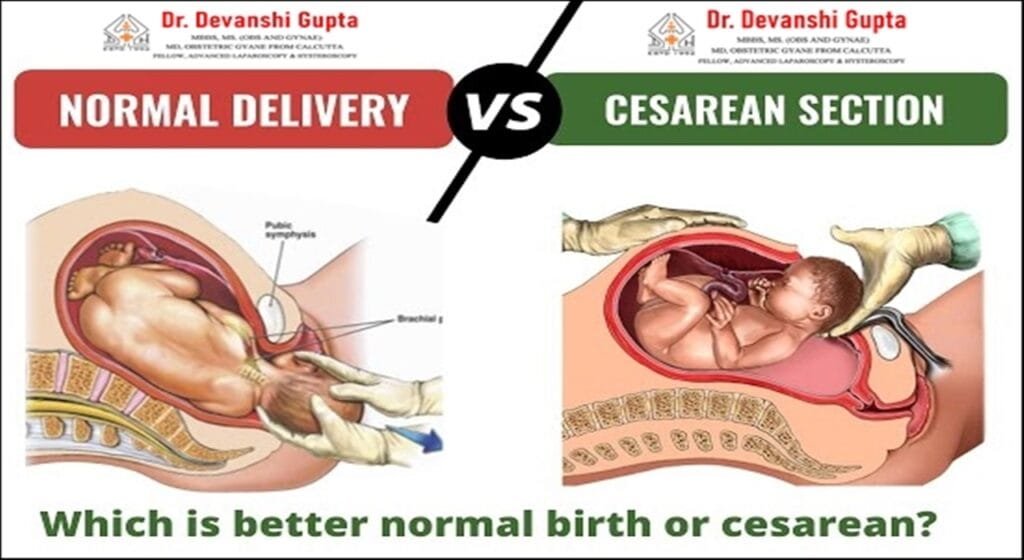 Best Caesarian And Normal Delivery Doctor Lucknow - Dr Devanshi Gupta 