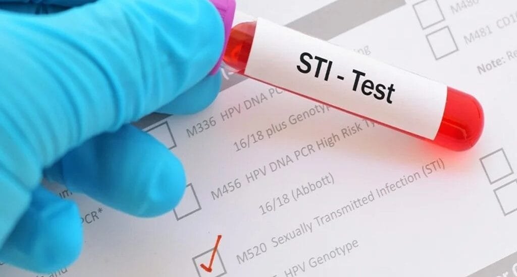 STI Screening lab testingby dr devanshi gpta