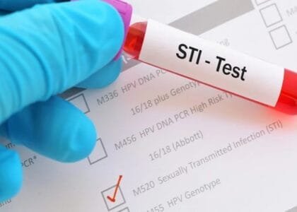 STI Screening lab testingby dr devanshi gpta