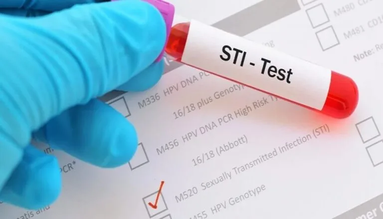 STI Screening (STD Test)
