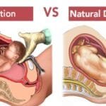 c sectionvs normal delivery 1024x440.png