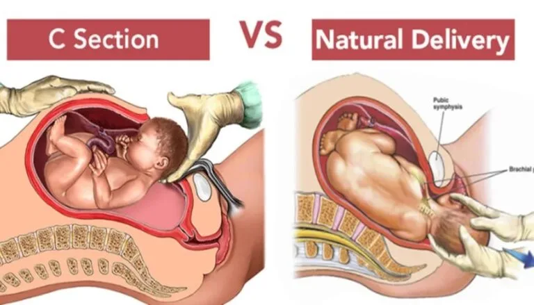 C-Section & Normal Delivery Specialist