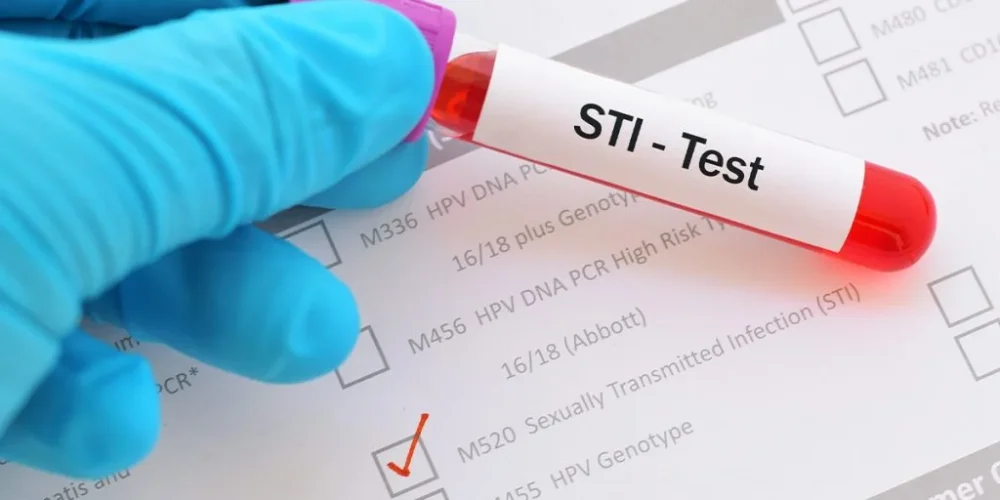 Sexually Transmitted Infection Doctor Lucknow